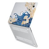 hardshell case with Japanese Pattern design has rubberized feet that keeps your MacBook from sliding on smooth surfaces