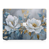 This lightweight, slim hardshell with Flower Art design is easy to install and fits closely to protect against scratches