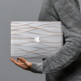 hardshell case with Luxury design combines a sleek hardshell design with vibrant colors for stylish protection against scratches, dents, and bumps for your Macbook